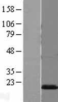 PMP2 Human Over-expression Lysate