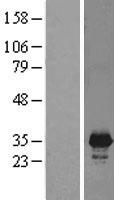 PNMT Human Over-expression Lysate