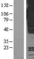 PIGR Human Over-expression Lysate