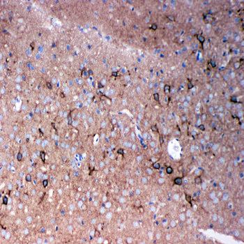 Tenascin-R TNR Rabbit Polyclonal Antibody