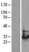 PGAM1 Human Over-expression Lysate