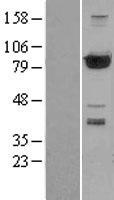 PFKP Human Over-expression Lysate