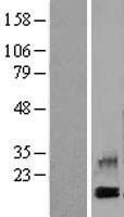 PF4 Human Over-expression Lysate