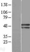 PEDF (SERPINF1) Human Over-expression Lysate
