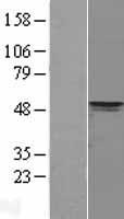 PDK4 Human Over-expression Lysate
