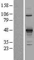 PDK2 Human Over-expression Lysate