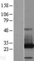 PAFAH1B3 Human Over-expression Lysate