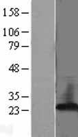 PBP (PEBP1) Human Over-expression Lysate