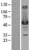 Ornithine Decarboxylase (ODC1) Human Over-expression Lysate