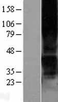 P2Y1 (P2RY1) Human Over-expression Lysate