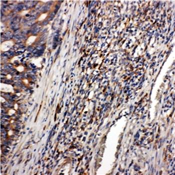 CD163 Rabbit Polyclonal Antibody