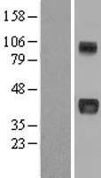 CCN3 (NOV) Human Over-expression Lysate