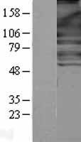 NFkB p100 / p52 (NFKB2) Human Over-expression Lysate