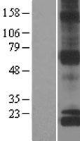 NDUFS8 Human Over-expression Lysate