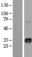 Myogenin (MYOG) Human Over-expression Lysate