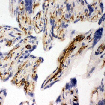 CD31/PECAM1 Rabbit Polyclonal Antibody
