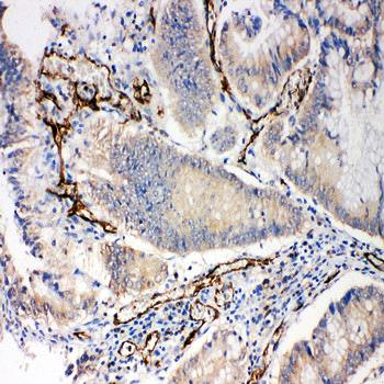 CD31/PECAM1 Rabbit Polyclonal Antibody