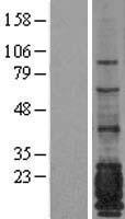 EMA (MUC1) Human Over-expression Lysate