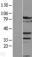 B MyB (MYBL2) Human Over-expression Lysate