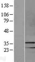 MSX1 Human Over-expression Lysate