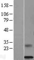 MSMB Human Over-expression Lysate