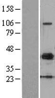 MMP10 Human Over-expression Lysate