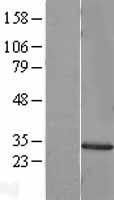 MMP7 Human Over-expression Lysate