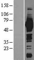 ME1 Human Over-expression Lysate