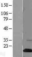 SH2D1A Human Over-expression Lysate