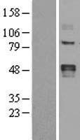 LOX Human Over-expression Lysate