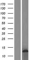 LY6E Human Over-expression Lysate