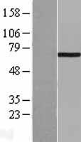 LIM Kinase 1 (LIMK1) Human Over-expression Lysate