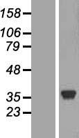 Lactate Dehydrogenase C (LDHC) Human Over-expression Lysate