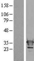 Galectin 3 (LGALS3) Human Over-expression Lysate