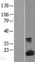 Galectin 1 (LGALS1) Human Over-expression Lysate
