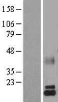 alpha Lactalbumin (LALBA) Human Over-expression Lysate