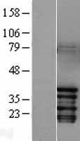c-Jun (JUN) Human Over-expression Lysate