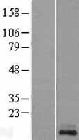 Kisspeptin (KISS1) Human Over-expression Lysate