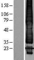 KCNK1 Human Over-expression Lysate