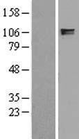 ITIH2 Human Over-expression Lysate
