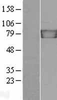 gamma Catenin (JUP) Human Over-expression Lysate