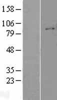 Integrin beta 1 (ITGB1) Human Over-expression Lysate