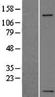 Integrin alpha 5 (ITGA5) Human Over-expression Lysate