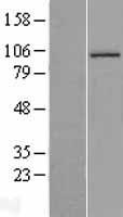 Aconitase 1 (ACO1) Human Over-expression Lysate