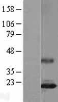 IL17 (IL17A) Human Over-expression Lysate