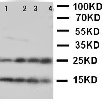 Nucleoplasmin-2 NPM2 Rabbit Polyclonal Antibody