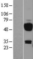 IL15RA Human Over-expression Lysate
