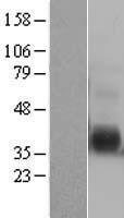 IL12B Human Over-expression Lysate