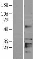 IGFBP6 Human Over-expression Lysate