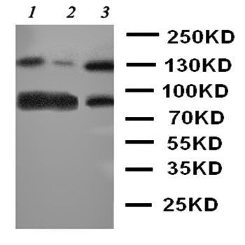TrkC/NTRK3 Rabbit Polyclonal Antibody